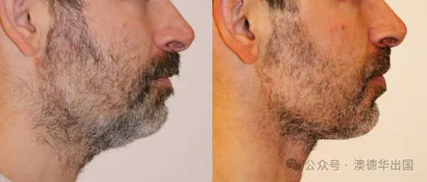 1762160123952887.png 2.webp.png