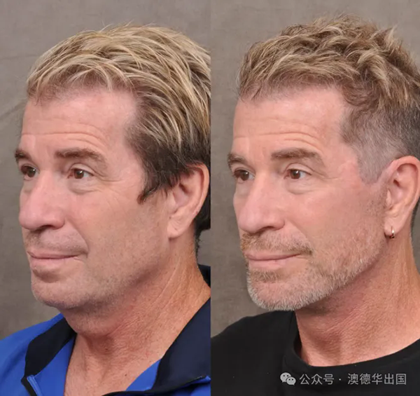 1762160128614966.png 3.webp.png